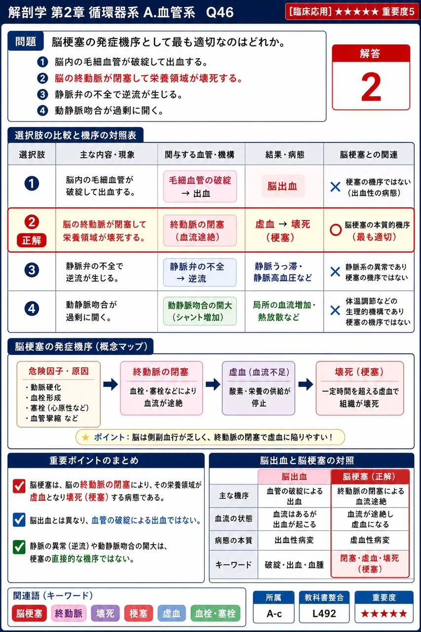 脳梗塞の発症機序として最も適切なのはどれか。 解説図