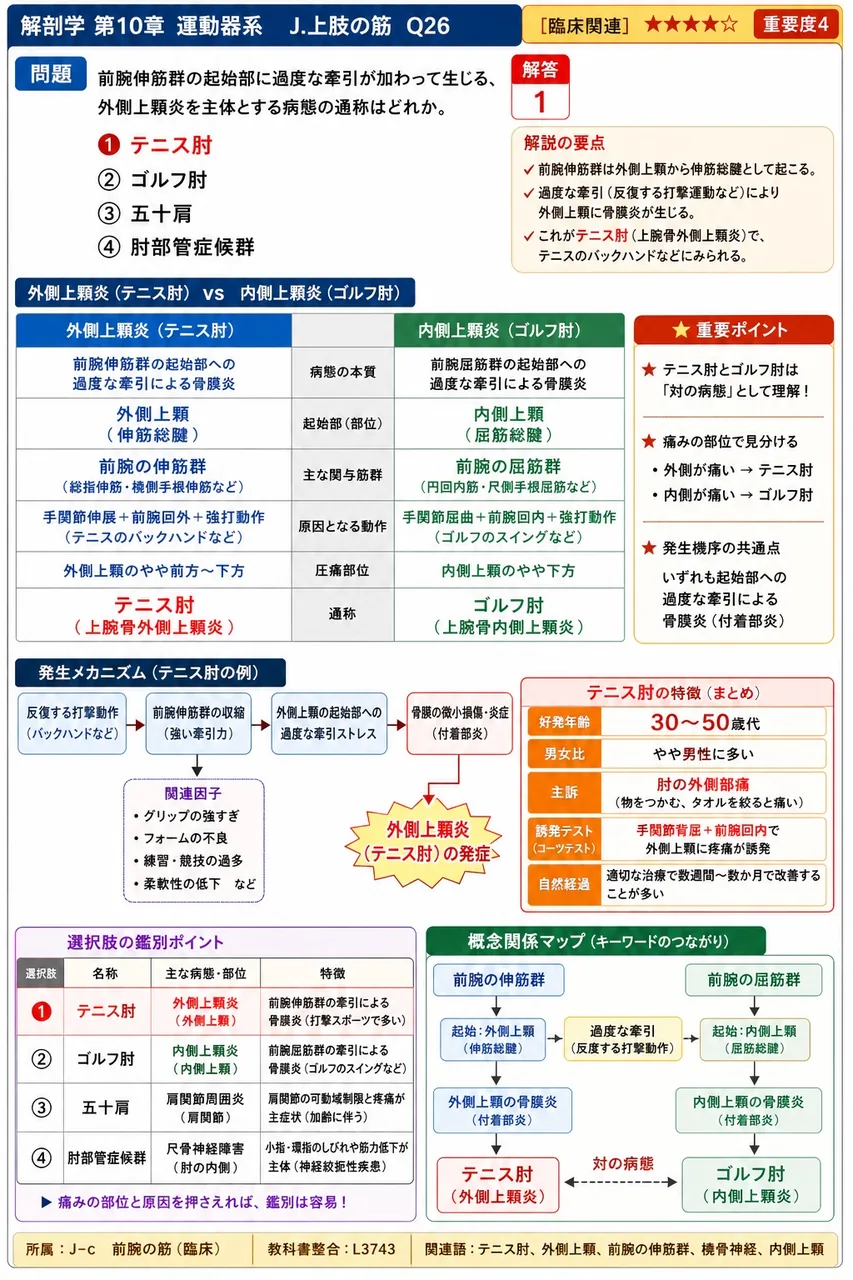 前腕伸筋群の起始部に過度な牽引が加わって生じる、外側上顆炎を主体とする病態の通称はどれか。 解説図