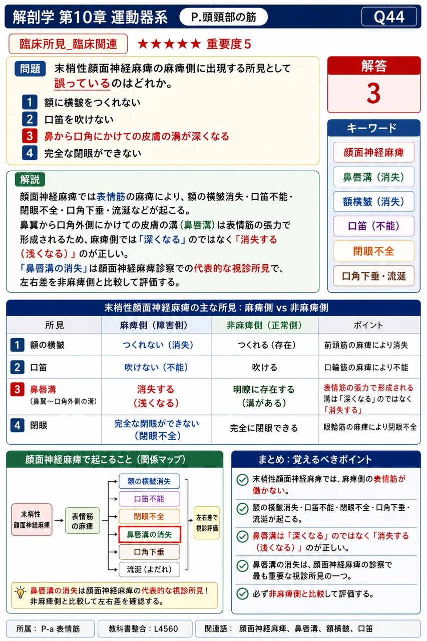 末梢性顔面神経麻痺の麻痺側に出現する所見として誤っているのはどれか。 解説図