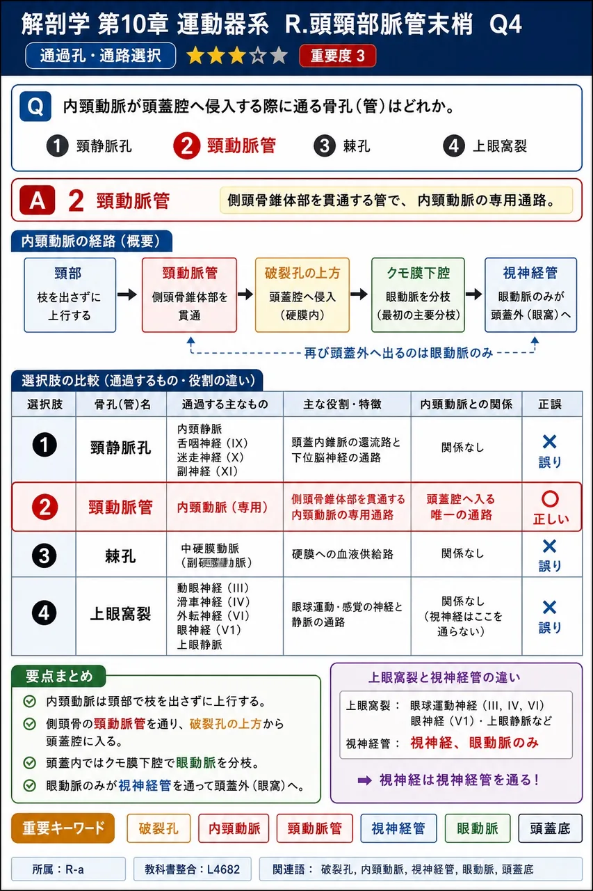 内頸動脈が頭蓋腔へ侵入する際に通る骨孔(管)はどれか。 解説図