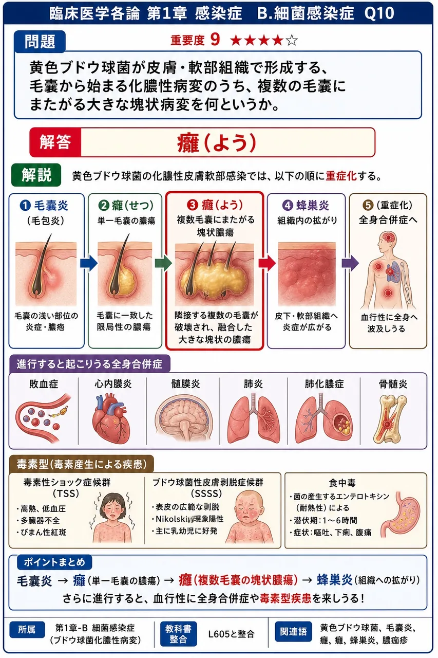黄色ブドウ球菌が皮膚・軟部組織で形成する、毛嚢から始まる化膿性病変のうち、複数の毛嚢にまたがる大きな塊状病変を何というか。 解説図