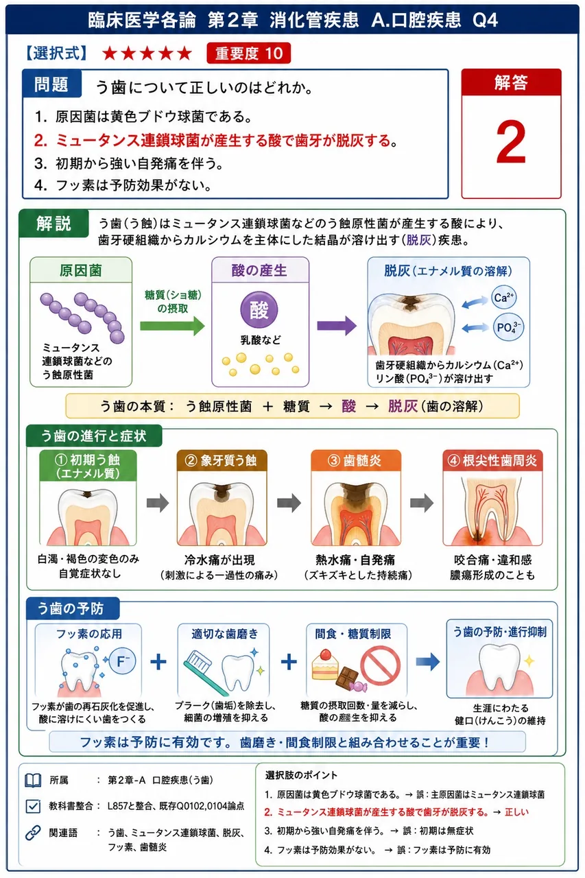う歯について正しいのはどれか。 解説図