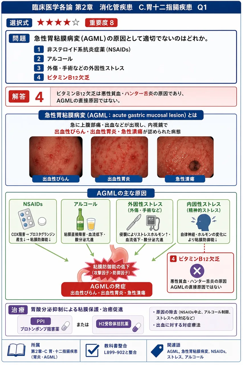 急性胃粘膜病変(AGML)の原因として適切でないのはどれか。 解説図