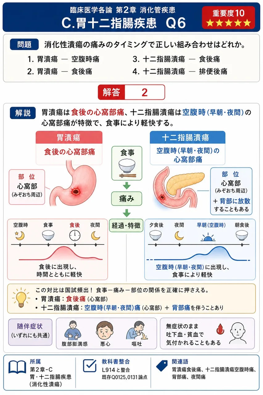 消化性潰瘍の痛みのタイミングで正しい組み合わせはどれか。 解説図