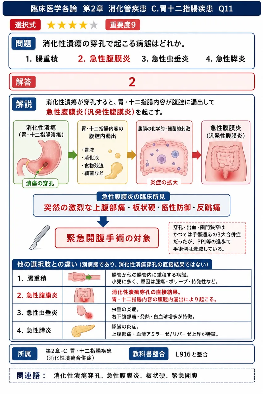 消化性潰瘍の穿孔で起こる病態はどれか。 解説図