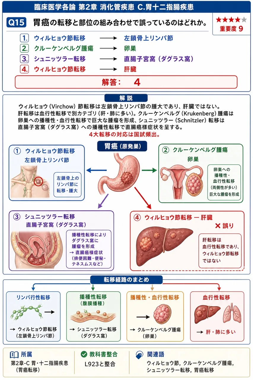 胃癌の転移と部位の組み合わせで誤っているのはどれか。 解説図