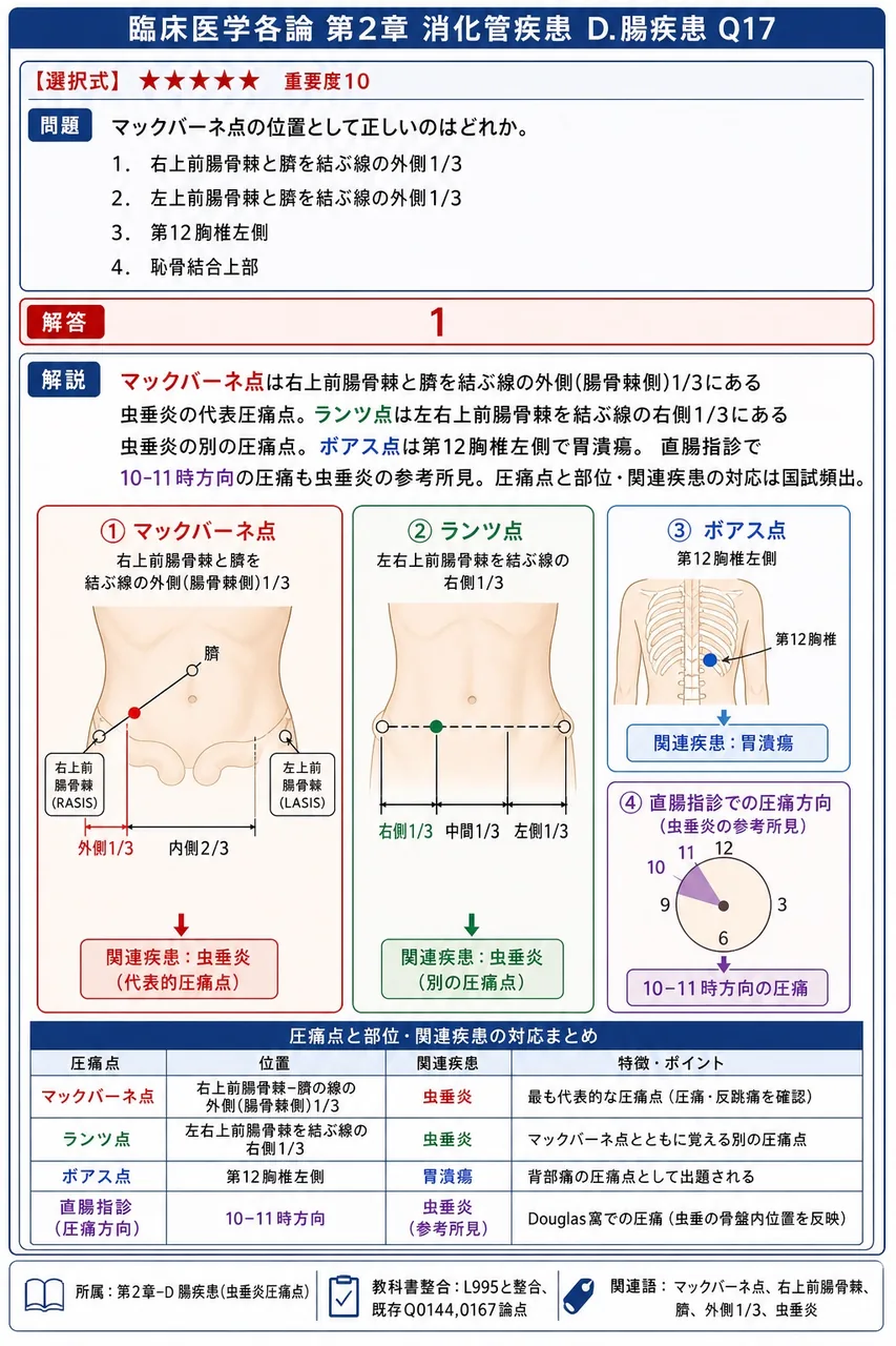 マックバーネ点の位置として正しいのはどれか。 解説図