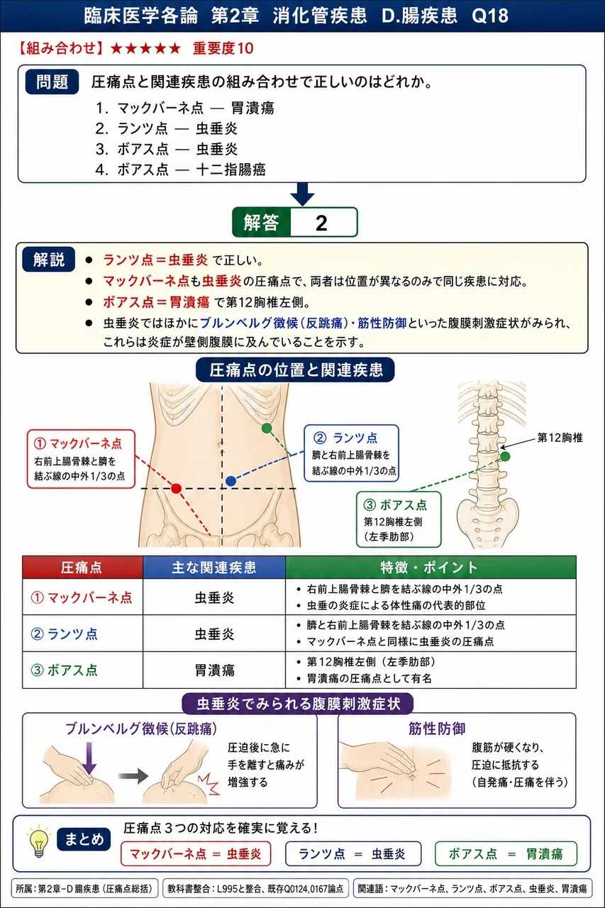 圧痛点と関連疾患の組み合わせで正しいのはどれか。 解説図