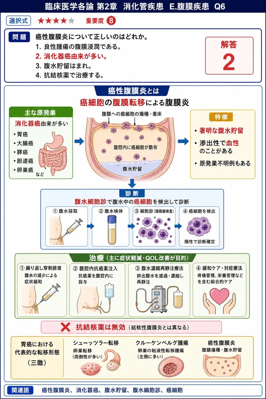 癌性腹膜炎について正しいのはどれか。 解説図