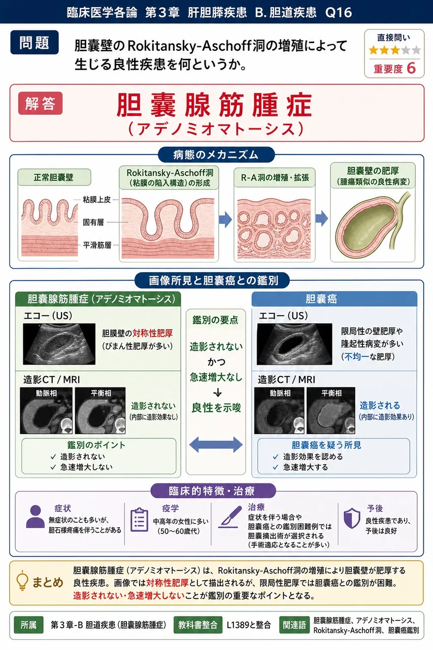 胆嚢壁のRokitansky-Aschoff洞の増殖によって生じる良性疾患を何というか。 解説図