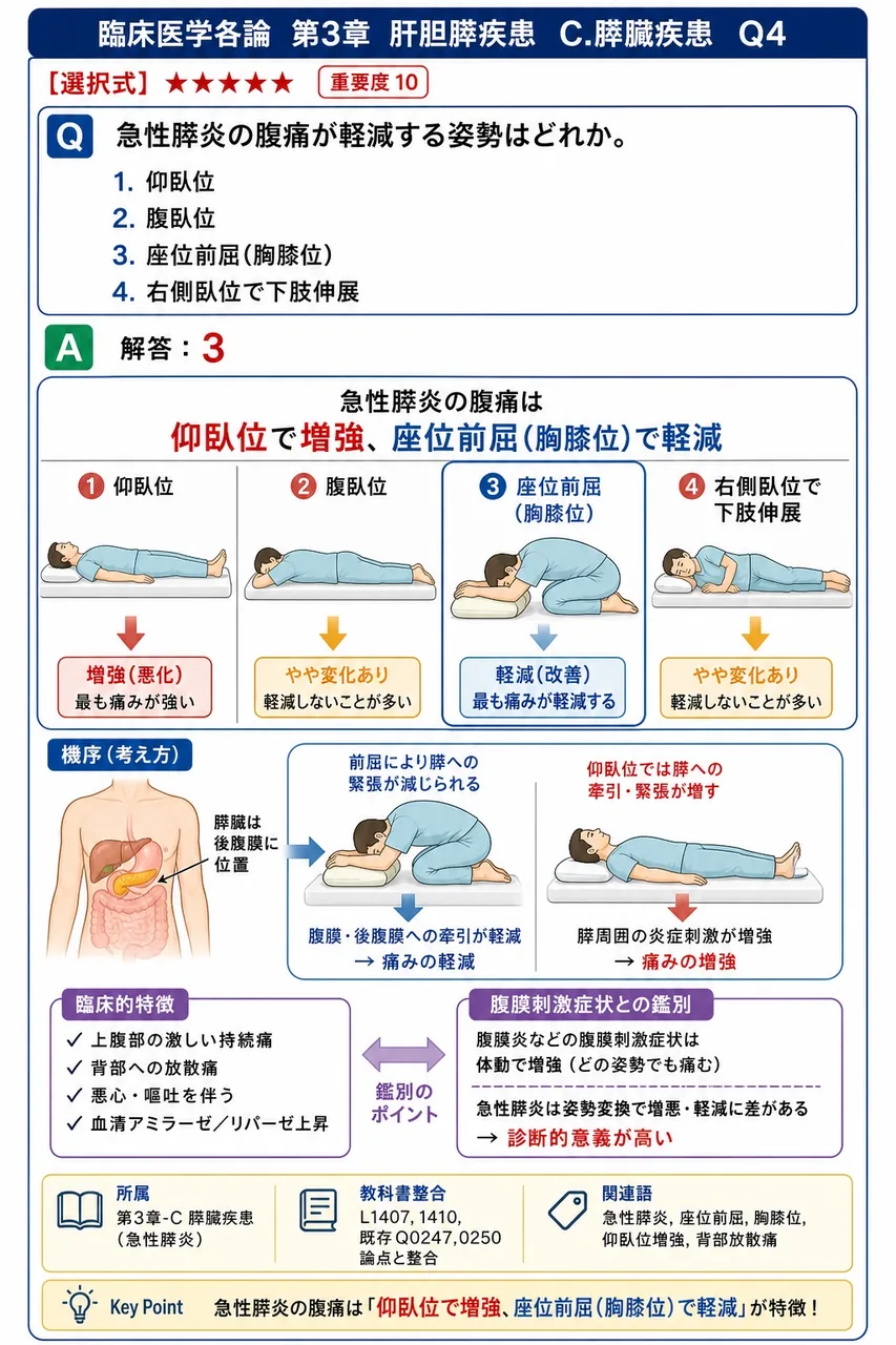 急性膵炎の腹痛が軽減する姿勢はどれか。 解説図