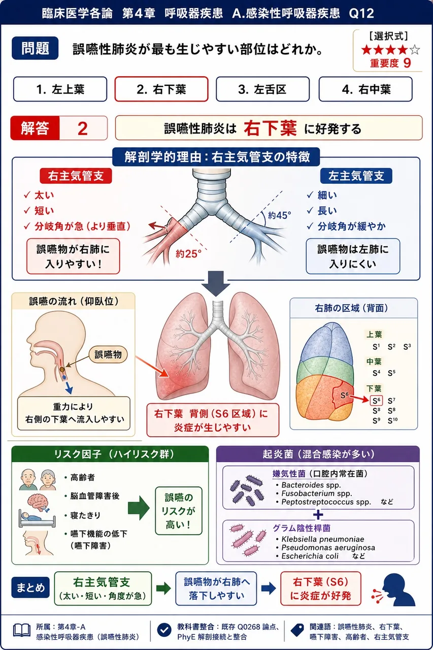 誤嚥性肺炎が最も生じやすい部位はどれか。 解説図