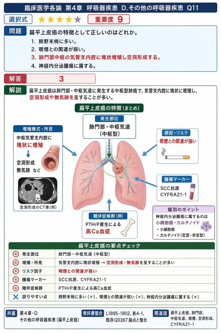 扁平上皮癌の特徴として正しいのはどれか。 解説図