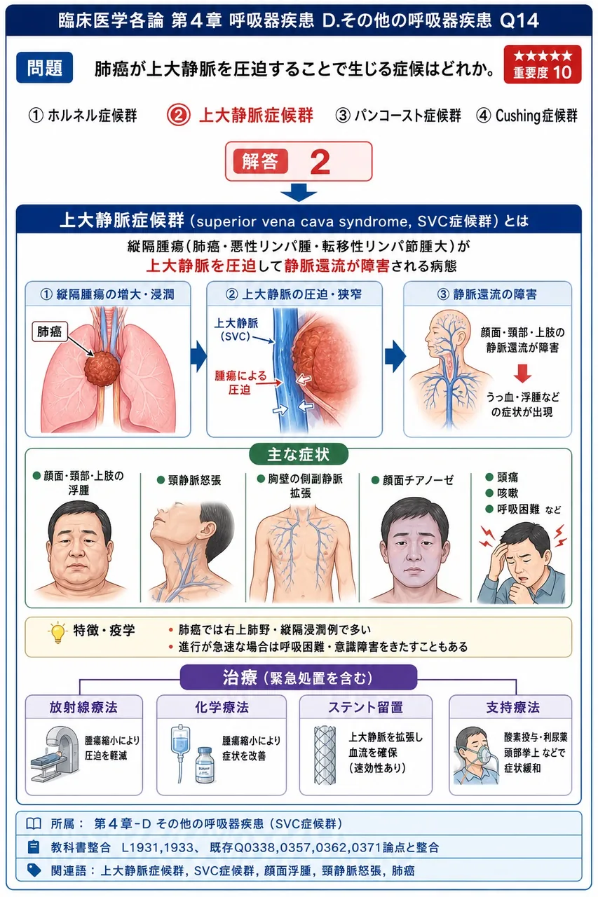 肺癌が上大静脈を圧迫することで生じる症候はどれか。 解説図