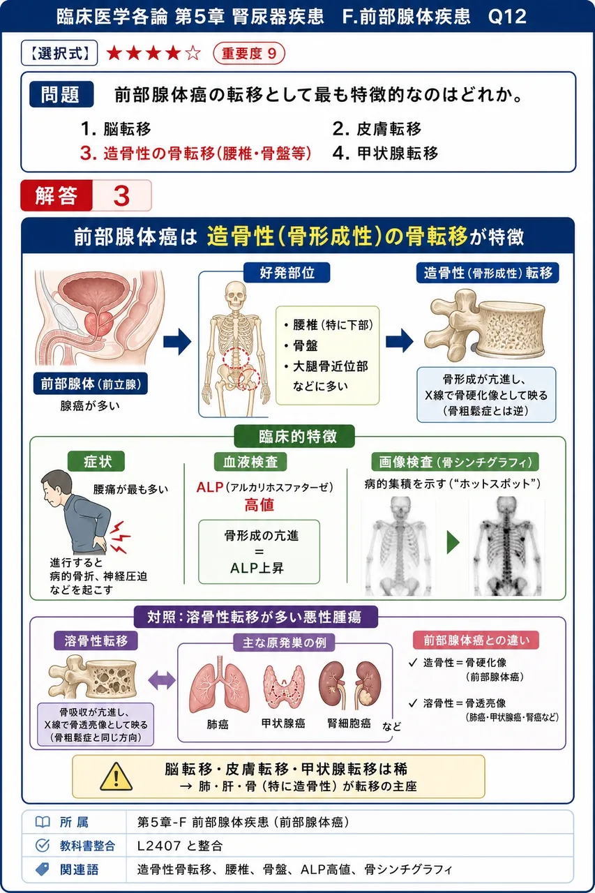 前立腺癌の転移として最も特徴的なのはどれか。 解説図