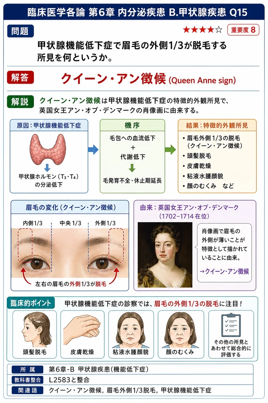 甲状腺機能低下症で眉毛の外側1/3が脱毛する所見を何というか。 解説図