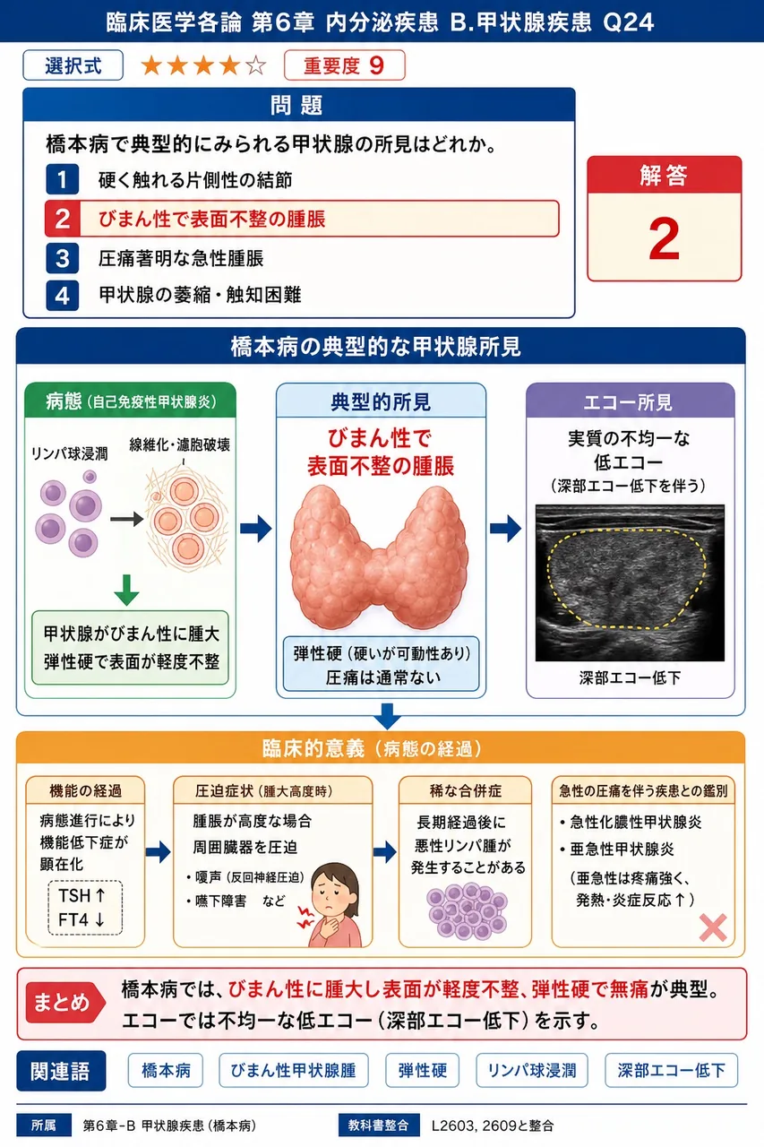 橋本病で典型的にみられる甲状腺の所見はどれか。 解説図
