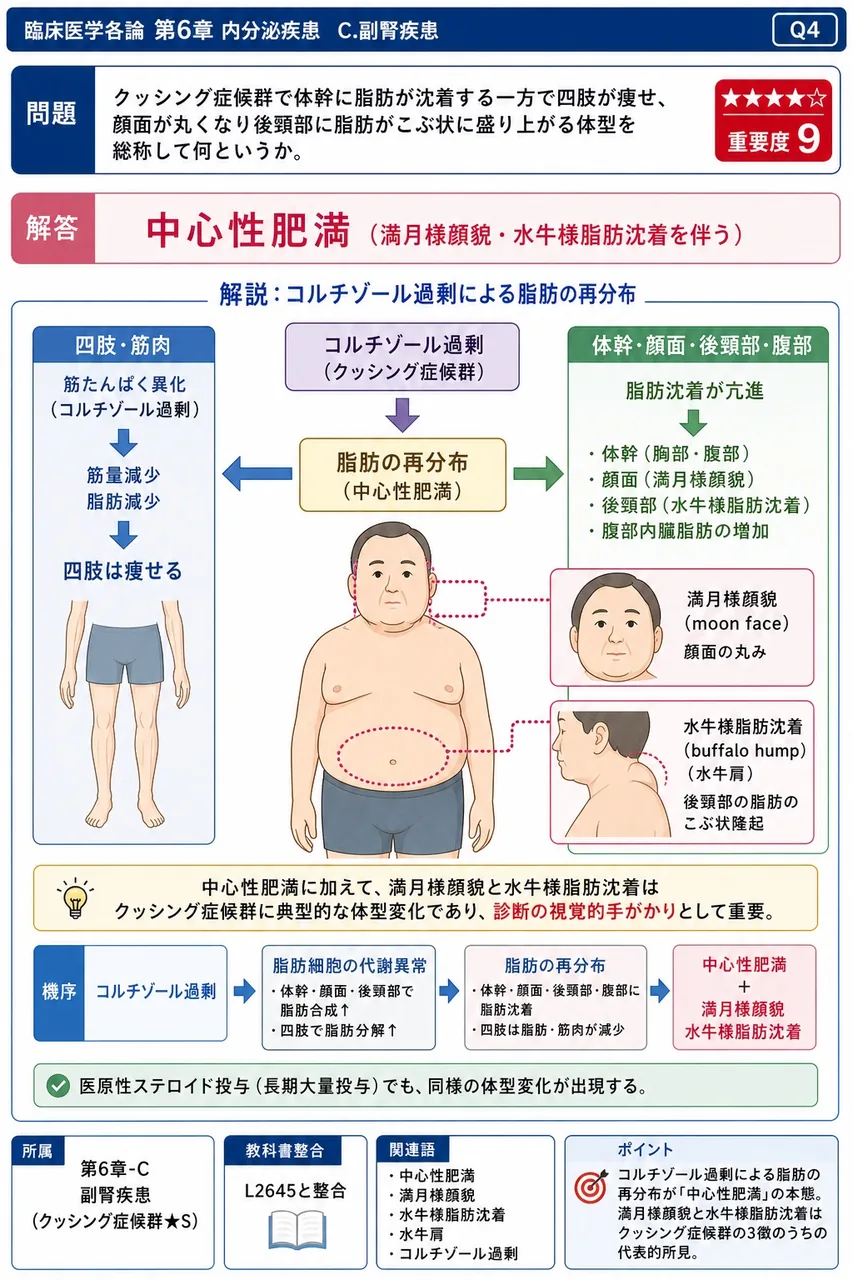 クッシング症候群で体幹に脂肪が沈着する一方で四肢が痩せ、顔面が丸くなり後頸部に脂肪がこぶ状に盛り上がる体型を総称して何というか。 解説図