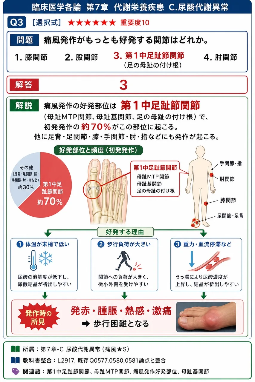 痛風発作がもっとも好発する関節はどれか。 解説図