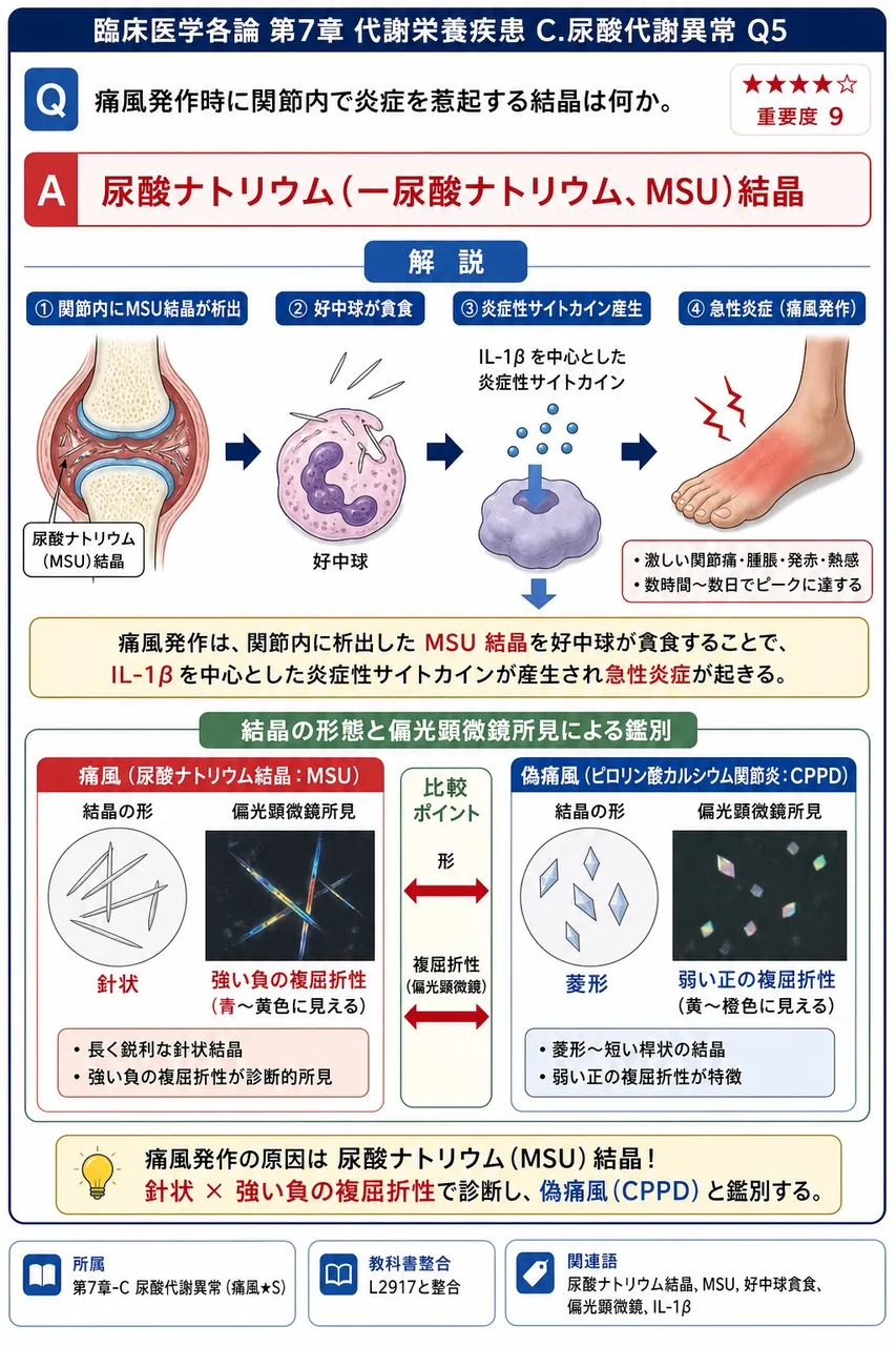 痛風発作時に関節内で炎症を惹起する結晶は何か。 解説図