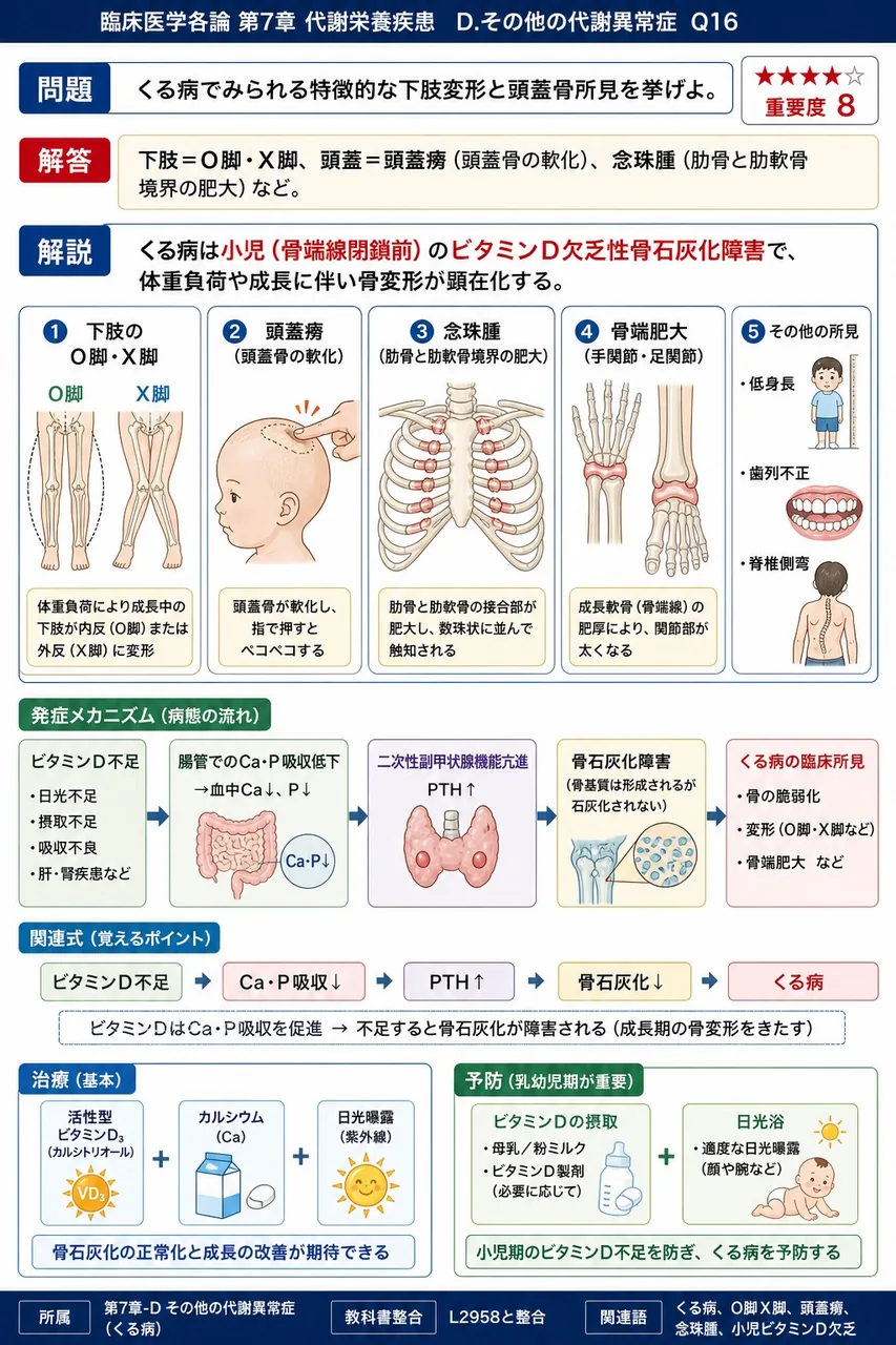 くる病でみられる特徴的な下肢変形と頭蓋骨所見を挙げよ。 解説図