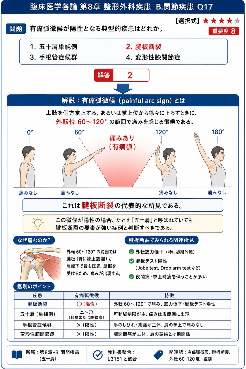 有痛弧徴候が陽性となる典型的疾患はどれか。 解説図