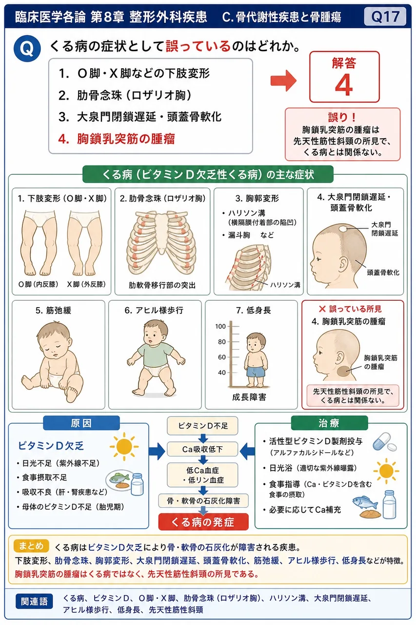 くる病の症状として誤っているのはどれか。 解説図