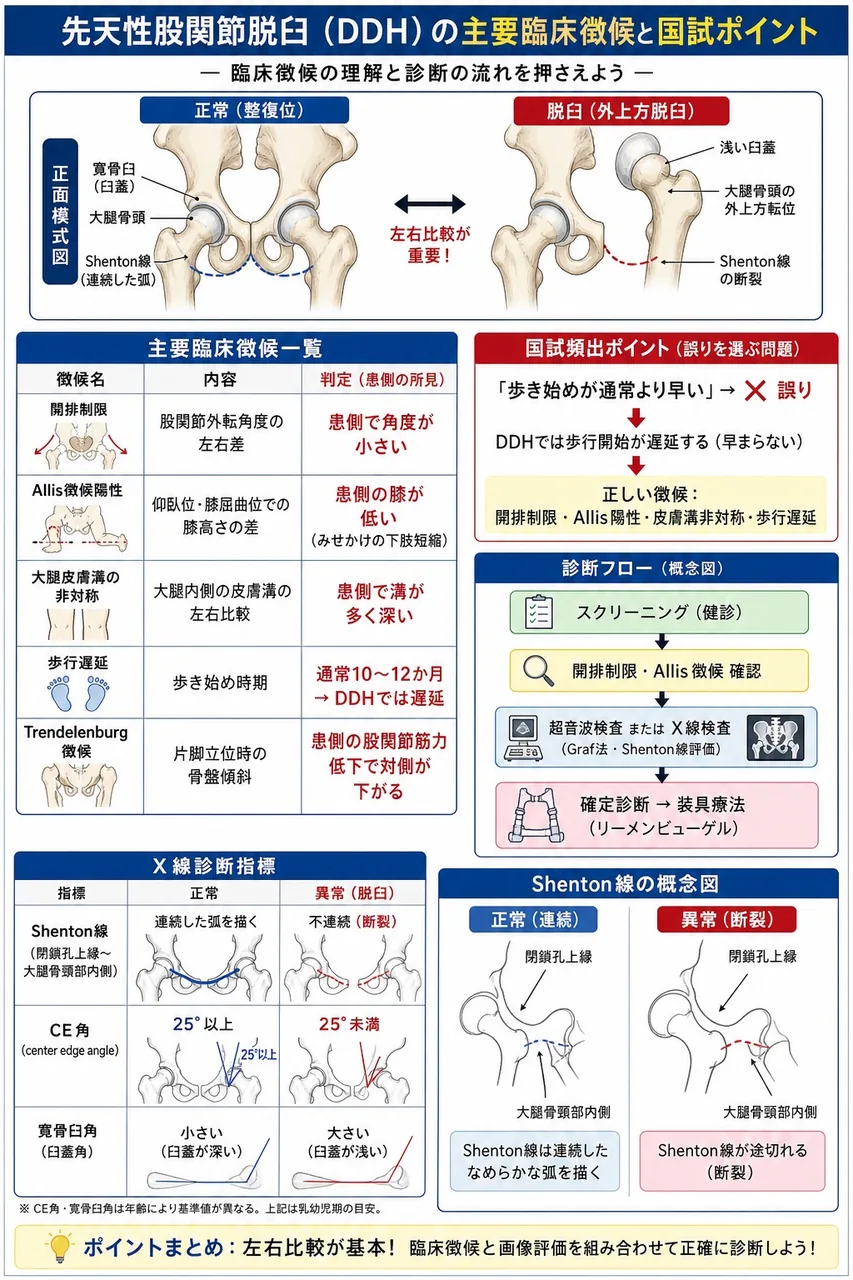 乳児期の先天性股関節脱臼の徴候として誤っているのはどれか。 解説図