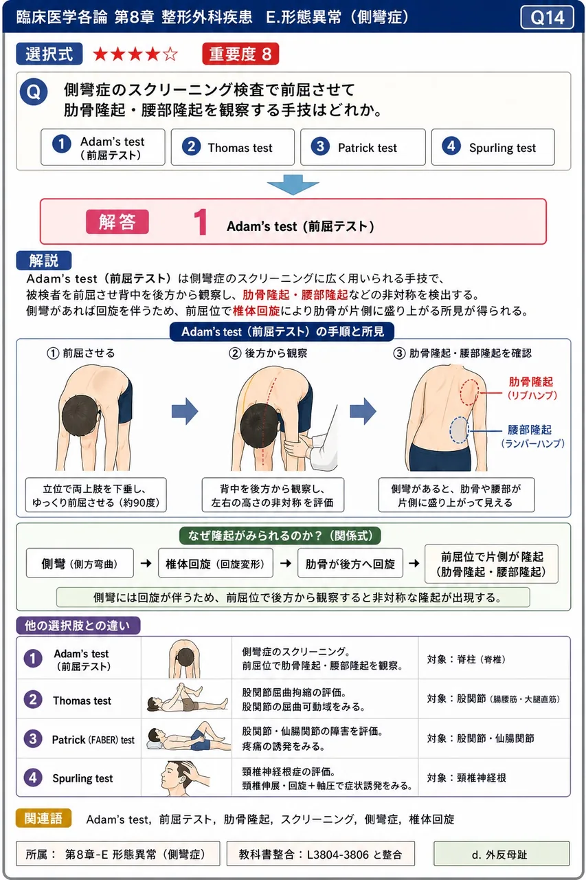 側彎症のスクリーニング検査で前屈させて肋骨隆起・腰部隆起を観察する手技はどれか。 解説図