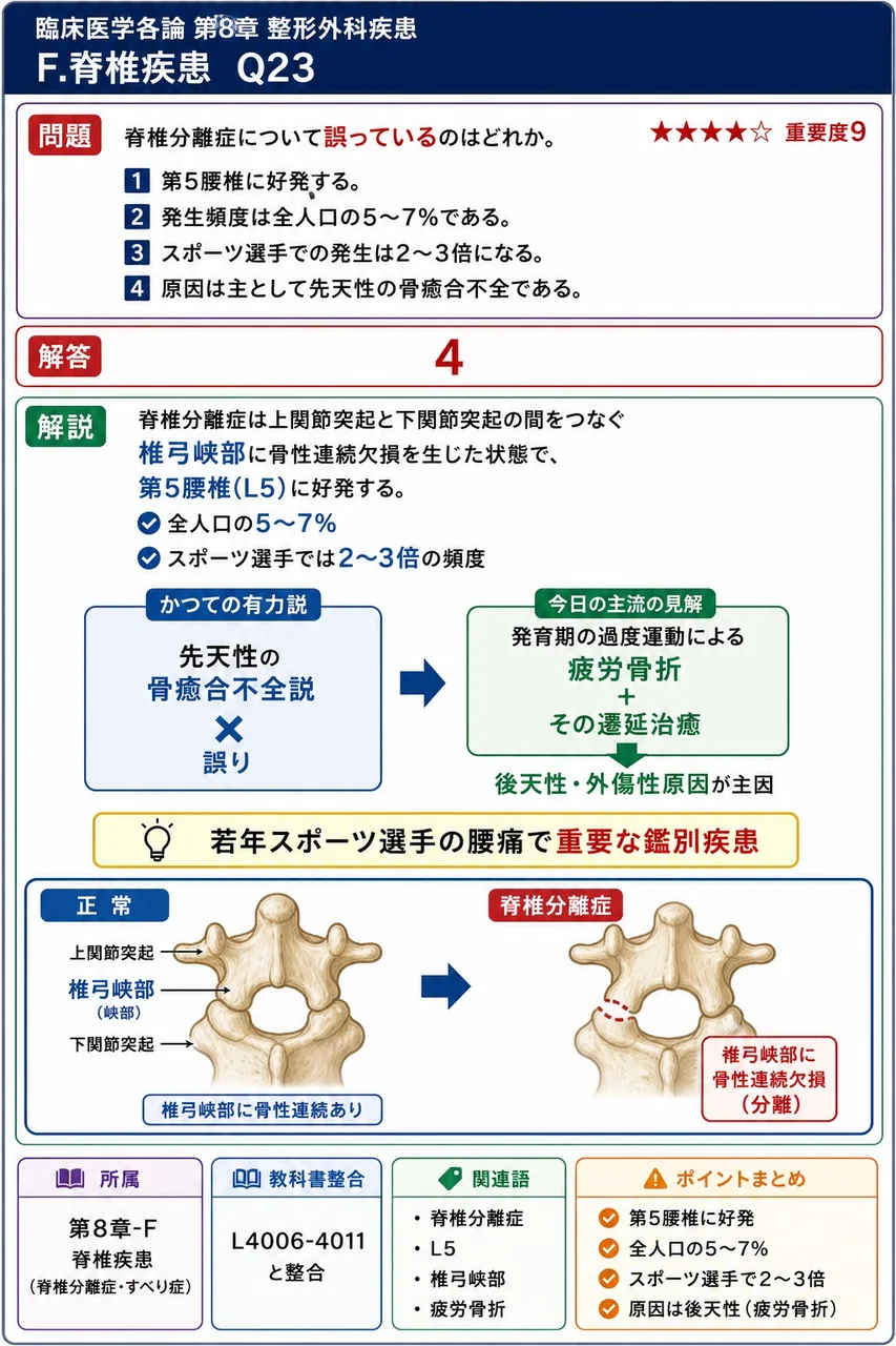 脊椎分離症について誤っているのはどれか。 解説図