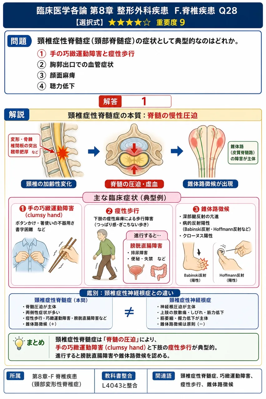 頸椎症性脊髄症(頸部脊髄症)の症状として典型的なのはどれか。 解説図