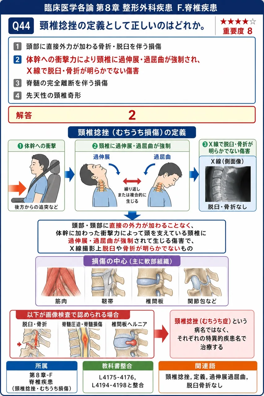 頸椎捻挫の定義として正しいのはどれか。 解説図