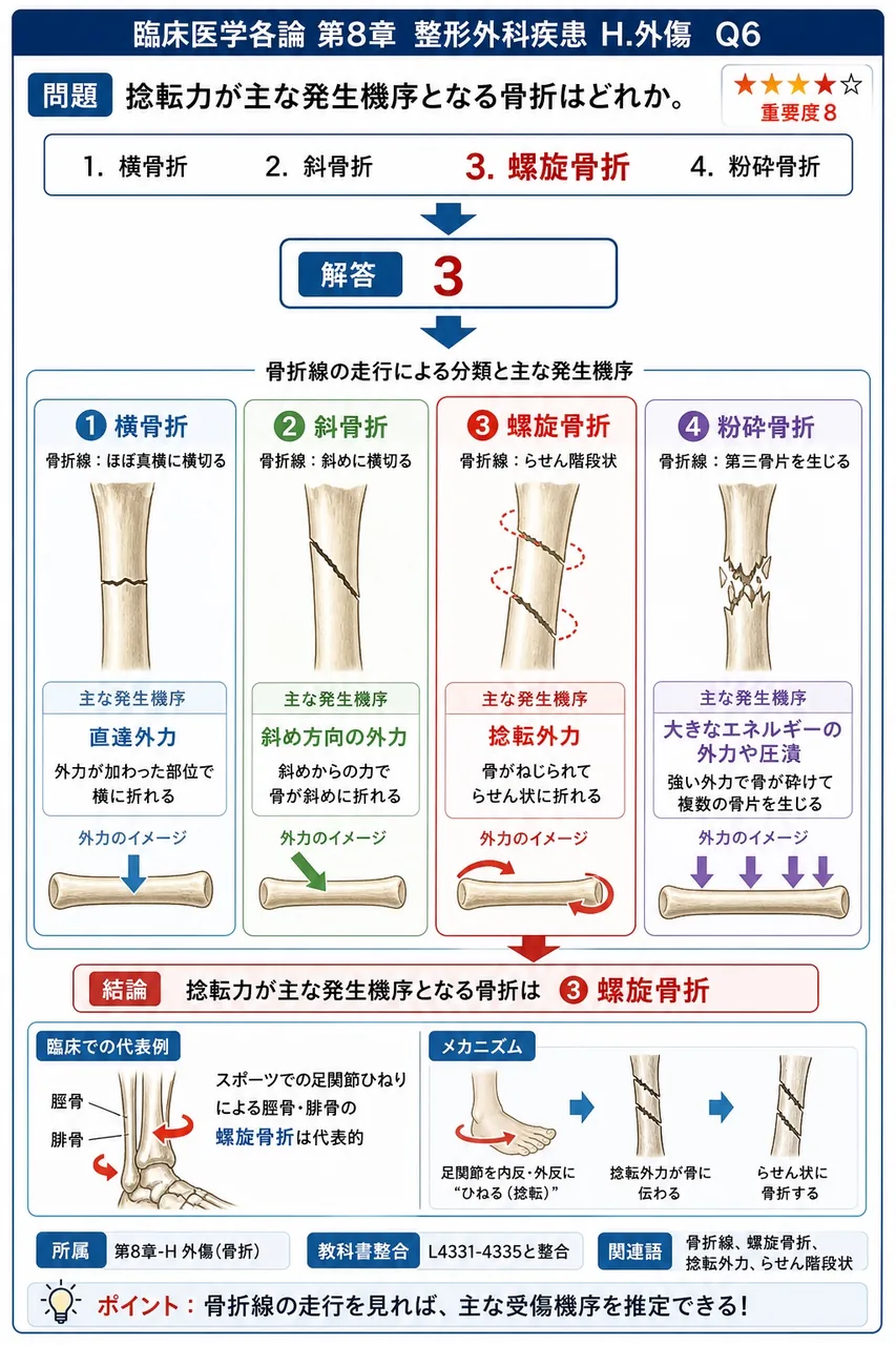 捻転力が主な発生機序となる骨折はどれか。 解説図