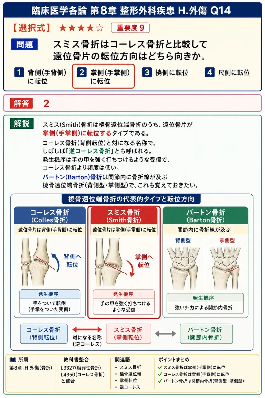 スミス骨折はコーレス骨折と比較して遠位骨片の転位方向はどちら向きか。 解説図