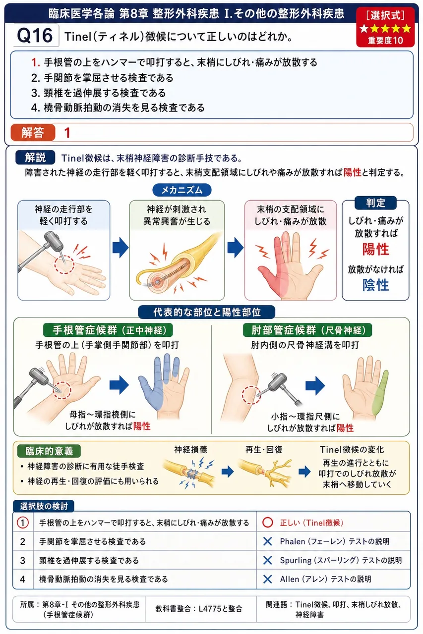 Tinel(ティネル)徴候について正しいのはどれか。 解説図