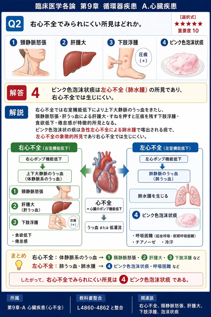 右心不全でみられにくい所見はどれか。 解説図