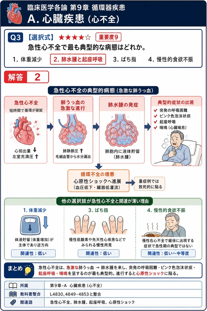 急性心不全で最も典型的な病態はどれか。 解説図