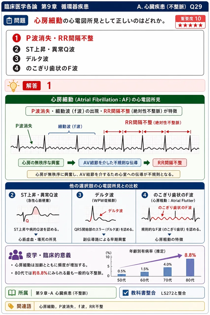 心房細動の心電図所見として正しいのはどれか。 解説図