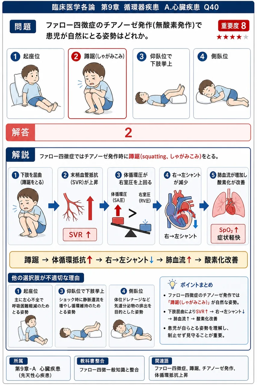ファロー四徴症のチアノーゼ発作(無酸素発作)で患児が自然にとる姿勢はどれか。 解説図
