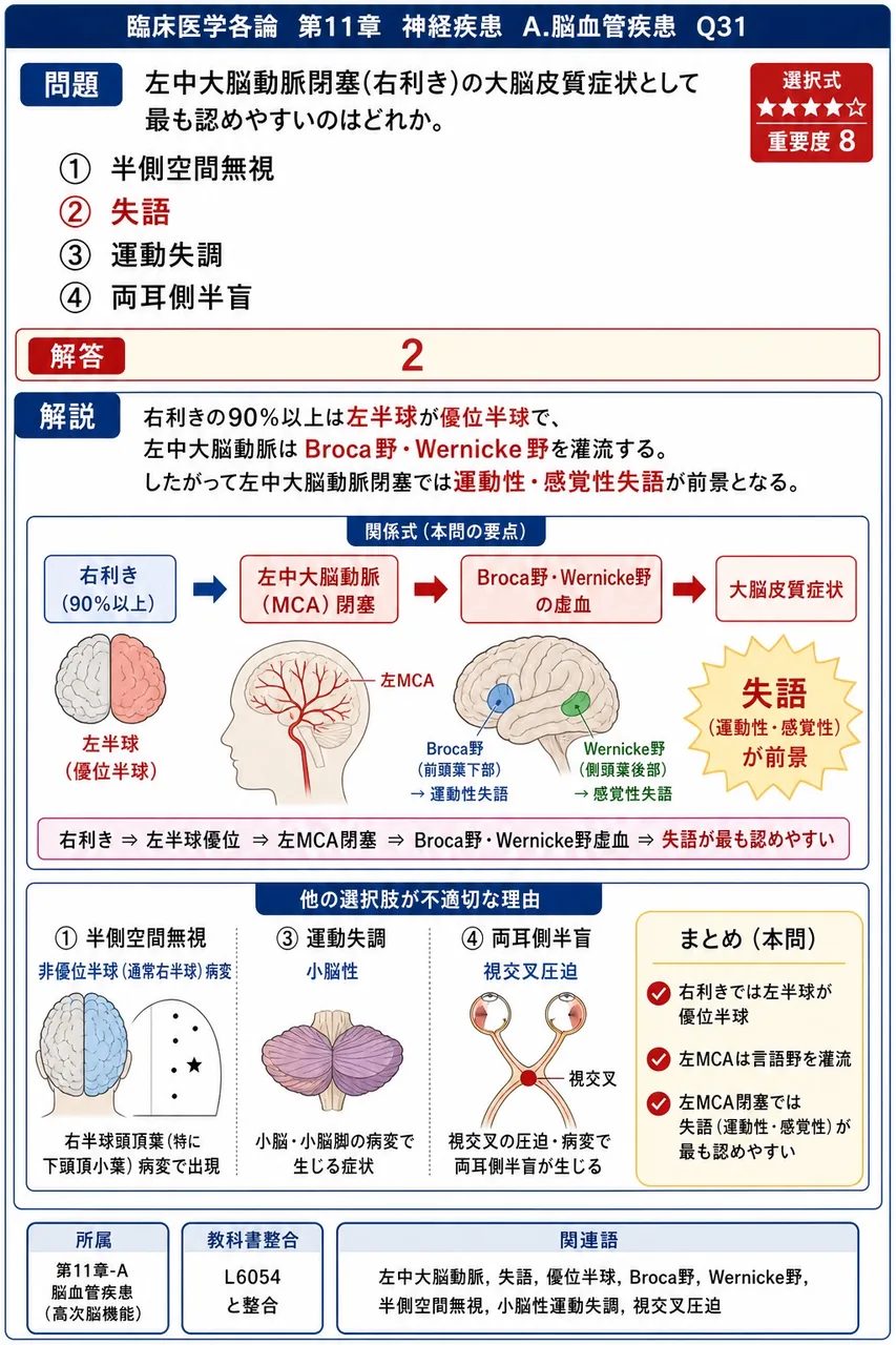 左中大脳動脈閉塞(右利き)の大脳皮質症状として最も認めやすいのはどれか。 解説図