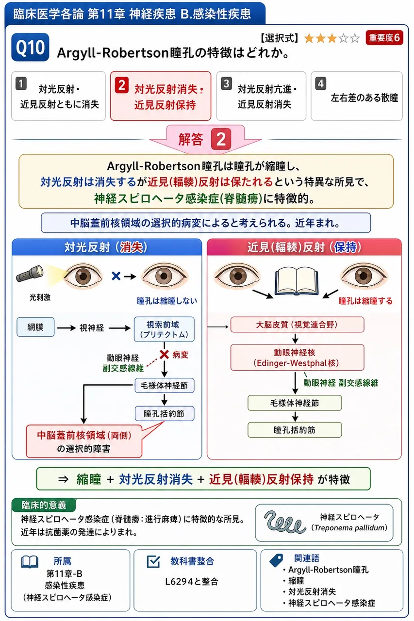 Argyll-Robertson瞳孔の特徴はどれか。 解説図