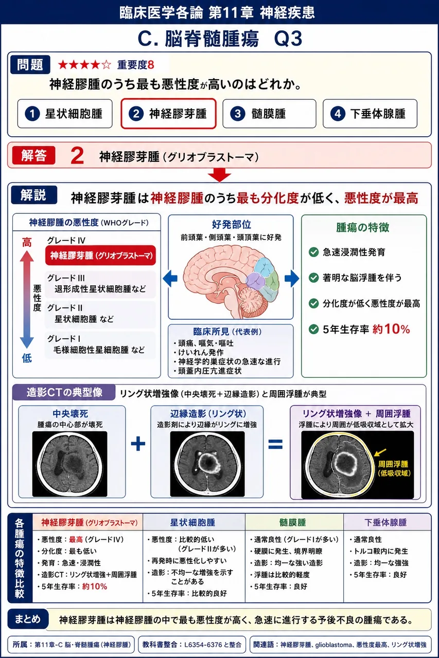 神経膠腫のうち最も悪性度が高いのはどれか。 解説図