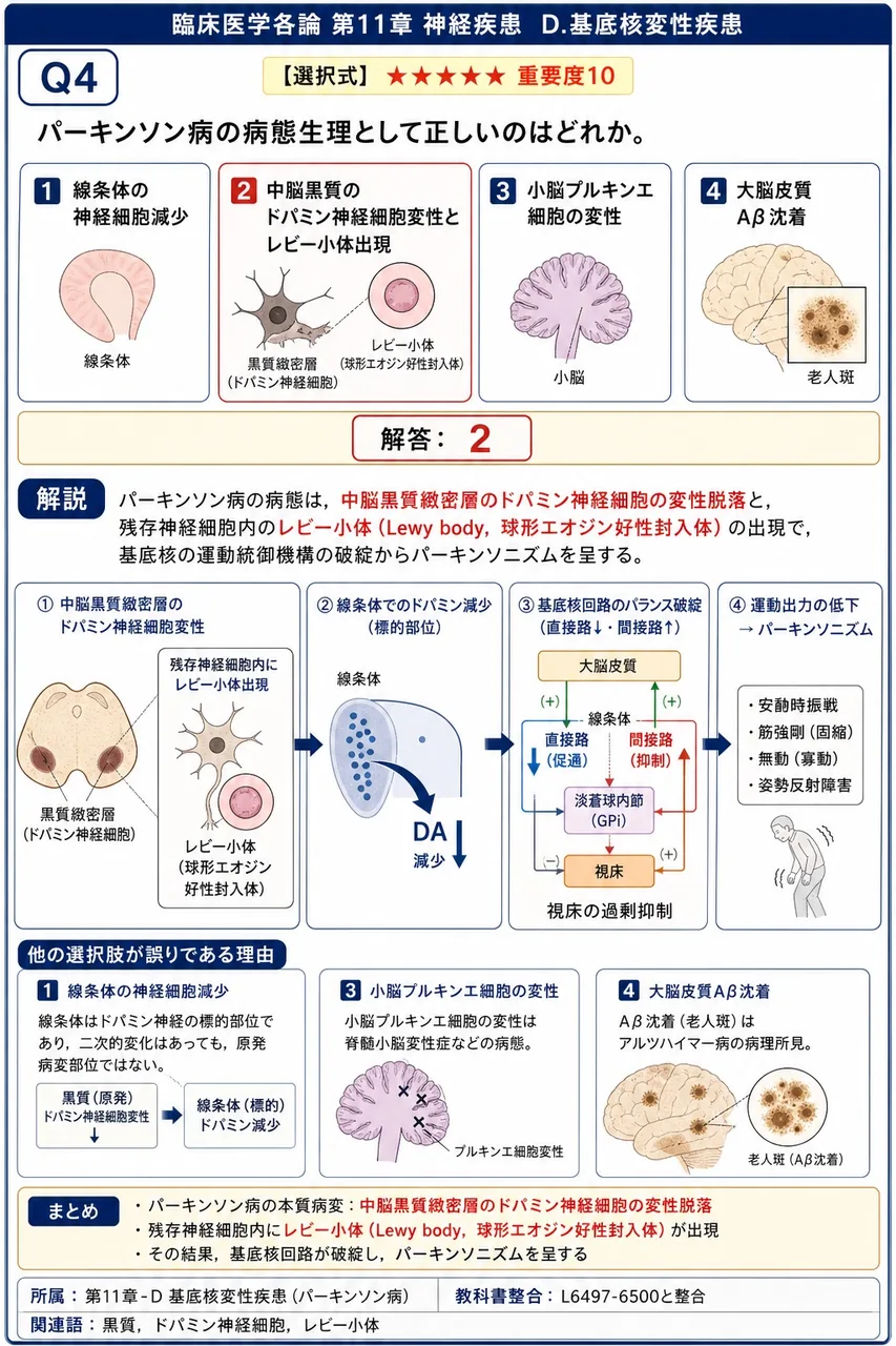パーキンソン病の病態生理として正しいのはどれか。 解説図