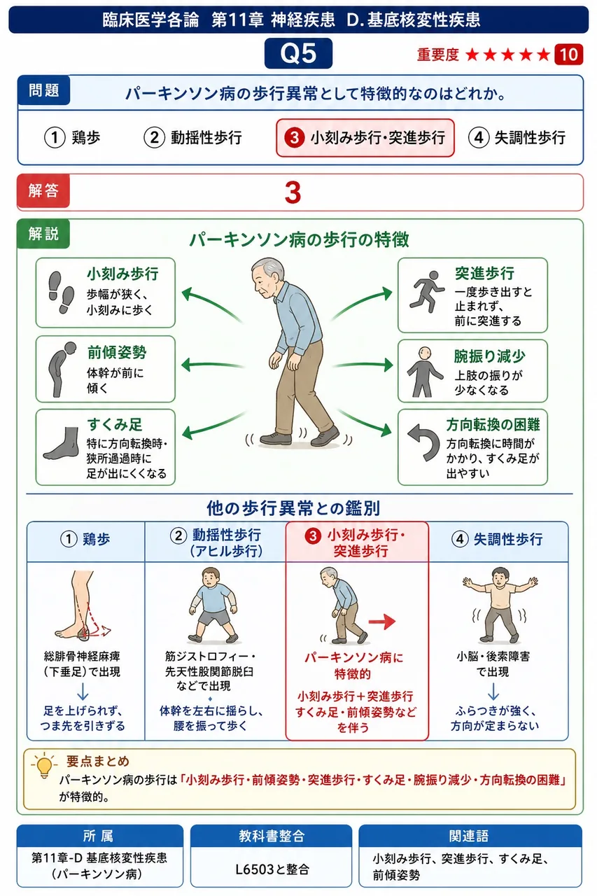 パーキンソン病の歩行異常として特徴的なのはどれか。 解説図