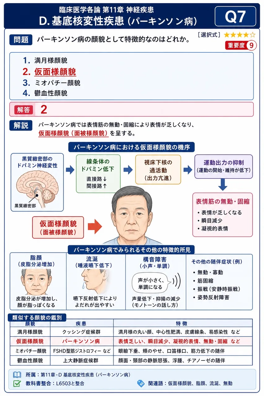 パーキンソン病の顔貌として特徴的なのはどれか。 解説図