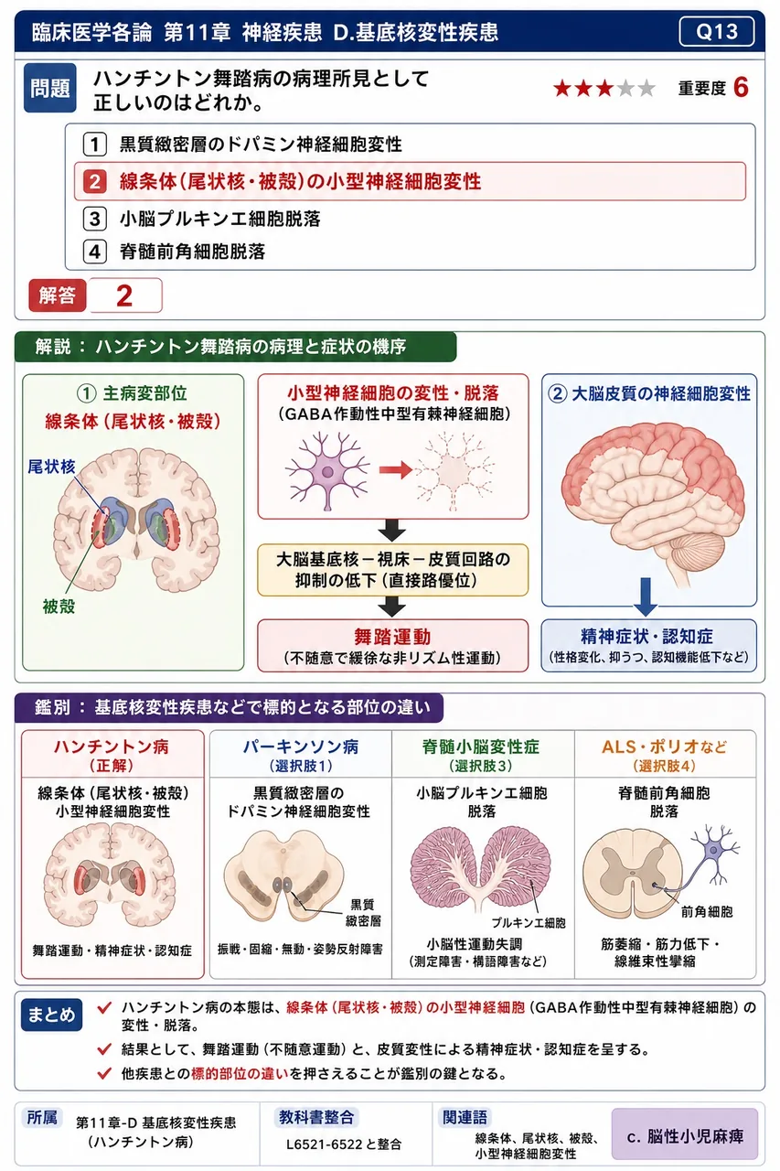 ハンチントン舞踏病の病理所見として正しいのはどれか。 解説図
