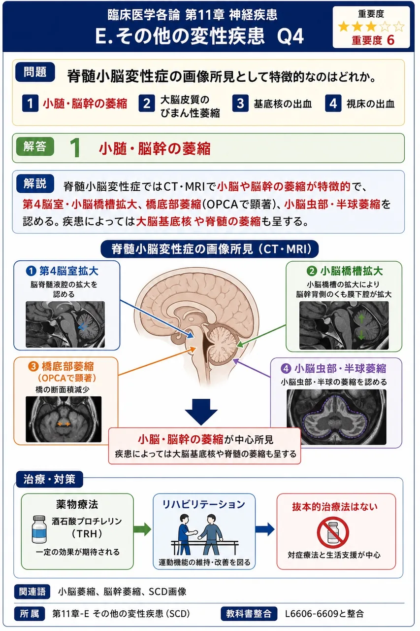 脊髄小脳変性症の画像所見として特徴的なのはどれか。 解説図