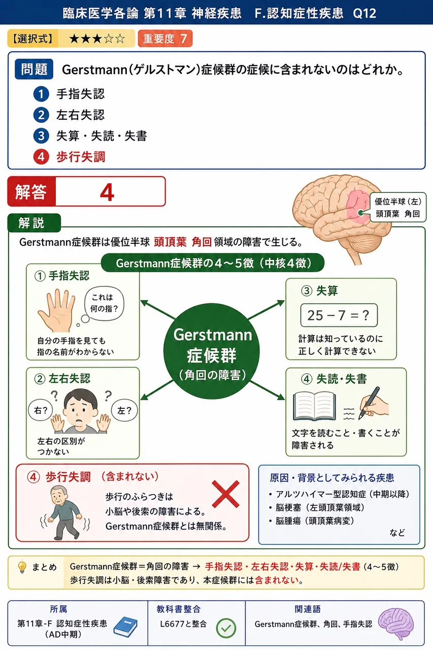 Gerstmann(ゲルストマン)症候群の症候に含まれないのはどれか。 解説図