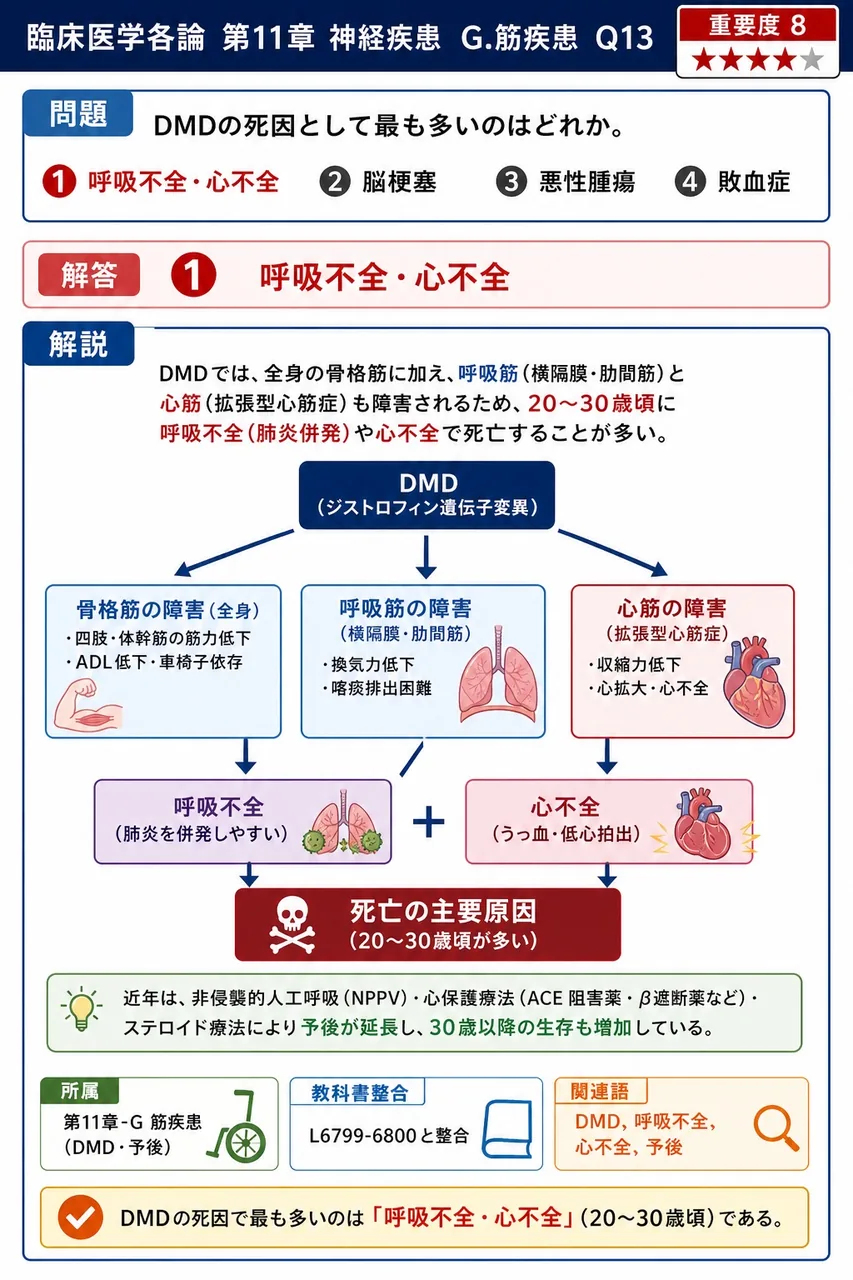 DMDの死因として最も多いのはどれか。 解説図