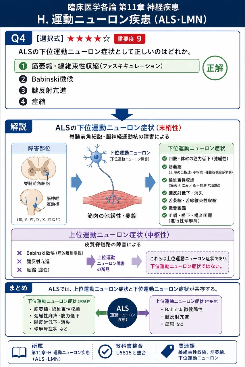 ALSの下位運動ニューロン症状として正しいのはどれか。 解説図